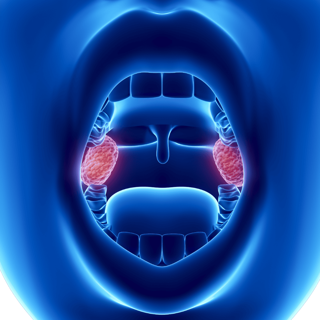 PCOS Treatment