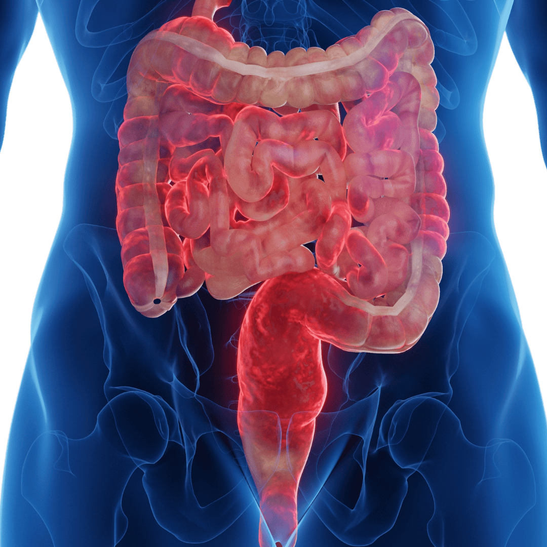 PCOS Treatment