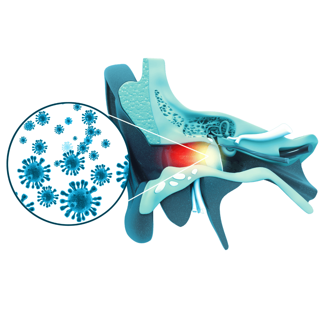 PCOS Treatment