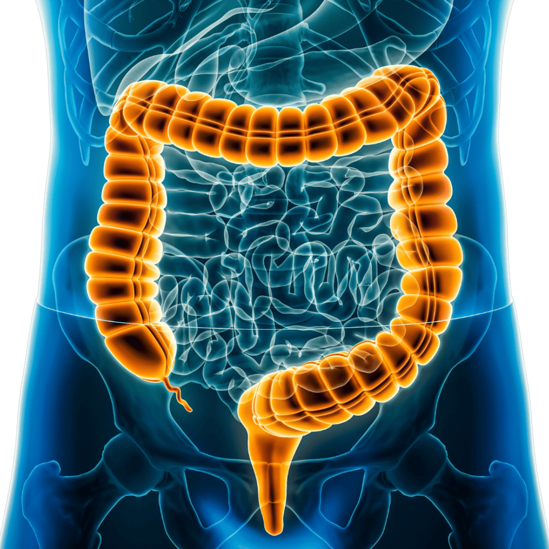 PCOS Treatment